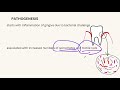 periodontal pocket 5mindentistry easy dental lecture notes