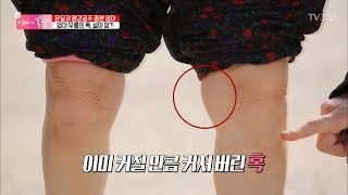 엄마의 다리에 이미 커져버린 혹! 설마 암?! [엄마의 봄날] 129회 20180225