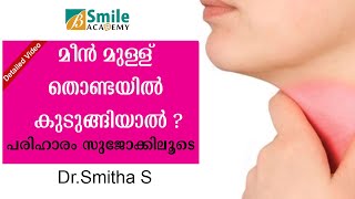 🆕How to remove Fishbone Stuck In Throat! Sujok Treatment Malayalam |മീൻ മുള്ള് തൊണ്ടയിൽ കുടുങ്ങിയാൽ