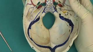 1.5 Step 11. Dural venous sinuses