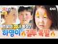 🔥질투 경보 발령🔥 연우를 빼앗긴 하영이, 나한테도 관심 좀 줘😠 #내아이의사생활 EP.11