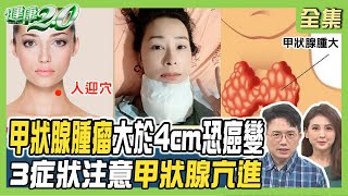 兵家綺罹癌切除甲狀腺 淋巴又有癌！甲亢練肝膽相照式 甲低練任脈調息式氣功！ 健康2.0 20240113【完整版】江坤俊 韋汝 鄭凱倫 陳欣湄 陳潮宗 彥寬 陳之穎 @tvbshealth20