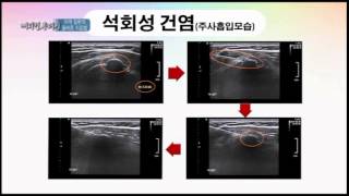 [플래티넘 정형외과] 급작스런 어깨통증 석회성건염!