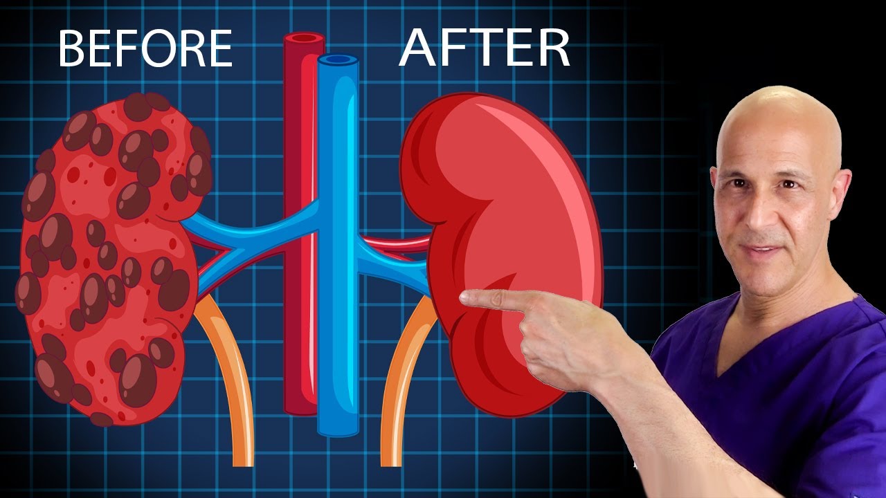 How To Heal Cleanse Your Kidneys Dr Mandell Youtube