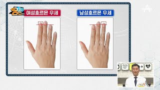 [성호르몬 밸런스 자가 진단법] 손가락 길이로 확인하는 호르몬 균형! | 나는 몸신이다 272 회