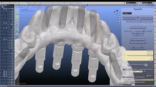 Making screw holes and angled screw holes through a hybrid