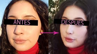 ¿Cara hinchada o gordita? El | Rutina de masaje matutino para eliminar la hinchazón| Chechu Beauty