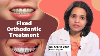 Fixed Orthodontic Treatment | Dr Arpita Dash | Swasthya Sambad | Odisha