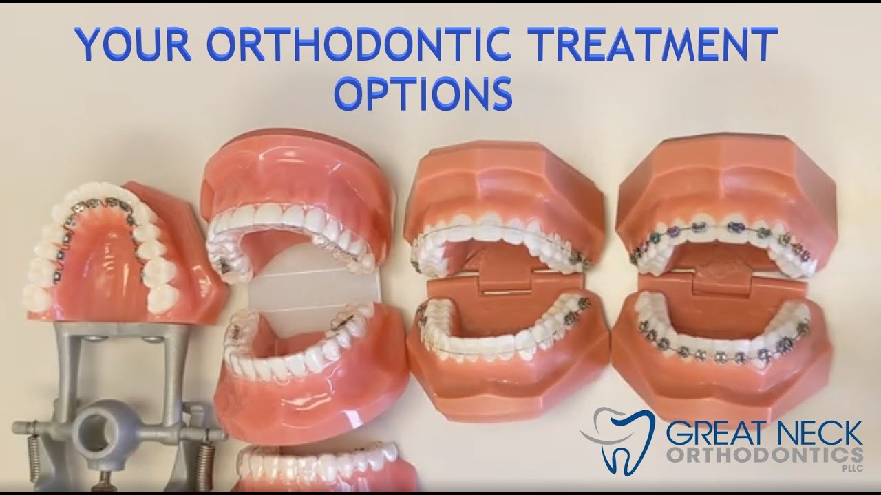 Your Orthodontic Treatment Options - YouTube