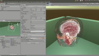 Volume Rendering in Unity