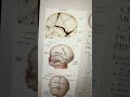 cranial movements during birth baby developmentaldelay atypical babymilestones