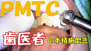 PMTCで歯ピカ動画（歯医者がする本格歯磨き）