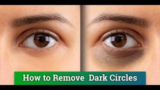 How To Use Natural Ingredients To Get Rid Of Dark Circles | Natural Skincare