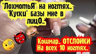 ВПЕРВЫЕ ТакоЕ вижу.. 🧐.. ОТСЛОЙКИ на всех НОГТЯХ /База снимается \