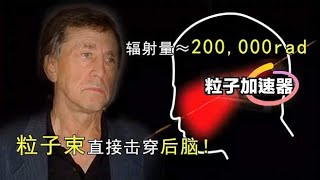 他意外把头伸进粒子加速器，被高能粒子直接击穿，结果怎么样了？