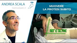 Protesi di caviglia: si muove subito | Protesi delle caviglia su misura | Dott. Andrea Scala