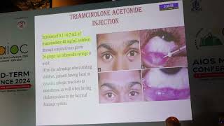 AIOCMT3 2024 - External - II-FP388-Dr.Meghna Mathur-Comparison of chalazion treatment with...