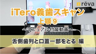 【マニュアル付属動画】iTero義歯スキャン（上顎⑨：舌側歯列と口蓋一部をとる）※20秒