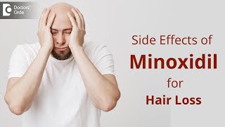 Side effects of Minoxidil for Hair Loss | TIPS to Deal This - Dr. Deepak P Devakar | Doctors' Circle