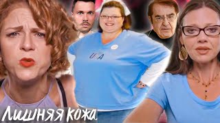 Разошлись из-за кожи ► Лишняя кожа Сезон 2 / 4