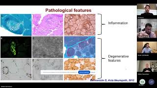 Les myopathies inflammatoires en 2024  - Mars 2024  Les soirées des Jeunes Internistes Francophones