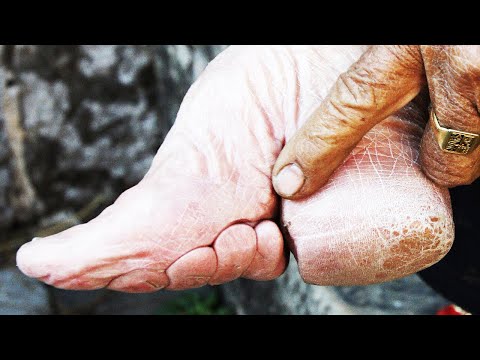Why do Japanese bind feet?