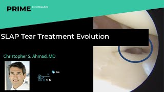 SLAP Tear Treatment Evolution - Christopher S. Ahmad, MD