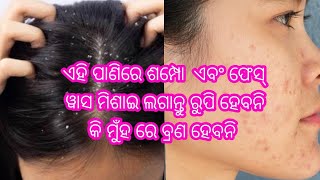 @ଏହି ଶାମ୍ପୁ ଲଗାନ୍ତୁ ମୁଣ୍ଡ ରୁ ରୁପି ବାହାରି ଯିବ, ଏବଂ ମୁଁହ ରେ ବ୍ରଣ ହେବ ନାହିଁ#natural home remedies