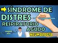 SDRA: Síndrome de Distrés Respiratorio Agudo FISIOPATOLOGÍA, FASES, SÍNTOMAS, MANEJO, TRATAMIENTO 📝