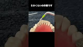 【戸塚駅前内藤歯科】強力な歯牙固定 #shorts #歯がグラグラ