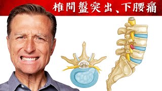 椎間盤凸出腰痛,強化韌帶吃錳,脊椎滑脫做平板支撐核心運動,自然療法,柏格醫生 Dr Berg