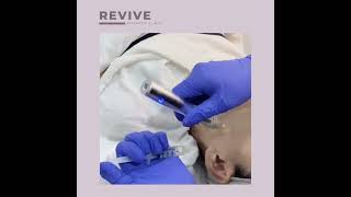 BCN Meso Therapy at Revive Aesthetic Clinic