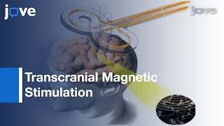 Documenting Phosphenes From Transcranial Magnetic Stimulation l Protocol Preview