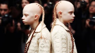 Meet The Rarest Black Twins In The World