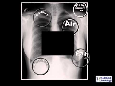 Learning Radiology - YouTube