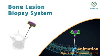 Kyphoplasty|The introduction to Bone Lesion Biopsy System|Vertebroplasty|KyphoplastyToolsSystem|bone