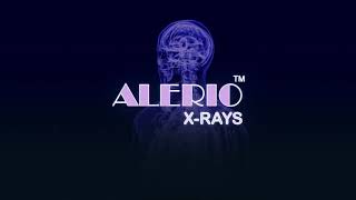 ALERIO X-Rays