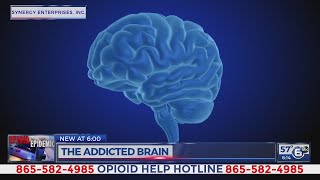 The Addicted Brain - opioids