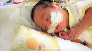 小っちゃい【Day 8】低出生体重児の成長記録 low birth weight infant