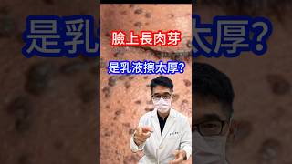 臉上長肉芽是因為❌❌擦太厚？！#皮膚科醫師 告訴你🤔 #吳仁欽皮膚科診所 #肉芽 #黑色丘疹 #息肉 #皮脂腺增生 #汗管瘤 #扁平疣 #冷凍治療 #液態氮 #汽化雷射 #二氧化碳雷射 #鉺雅鉻雷射