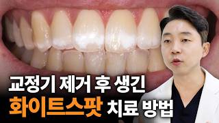 교정부작용 화이트 스팟 이렇게 치료합니다!