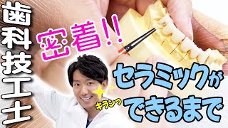 歯科技工士密着！湘南歯科こだわりのセラミックの制作過程お見せします。