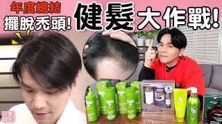 2021擺脫禿頭！你也能養出豐厚的頭髮 ll Kevin想得美 ll Best Hair Loss Treatments