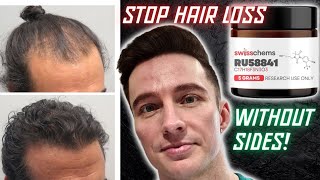 Why RU58841 is in My Hair Loss Protocol 2024