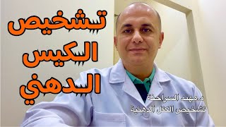 اعراض الكيس الدهني lipoma