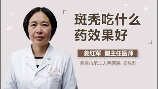 斑秃吃什么药效果好 有来医生