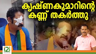 Actor Krishnakumar  | കൃഷ്ണകുമാറിന്റെ കണ്ണ് തകർത്തു | i2i NEWS