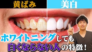 【ホワイトニング】歯が白くならない人の特徴と対処方法をプロの歯医者が解説！【歯を白くする方法】