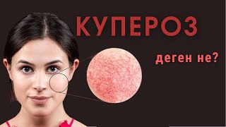 Купероз деген не?