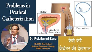 कैथीटेराइजेशन देखभाल | Problems after Urethral Catheterization & Solutions. | Dr. Santosh Kumar PGI